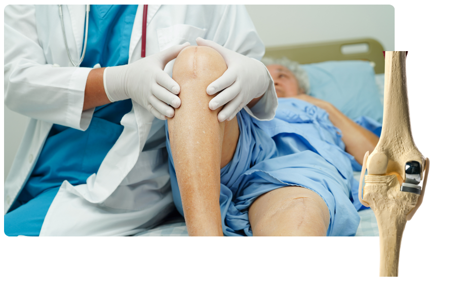 Partial Knee Replacement in Madgaon, Goa​