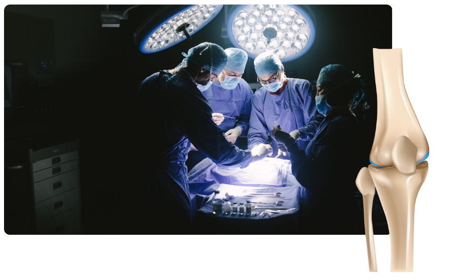 ACL Surgery in Madgaon, Goa​