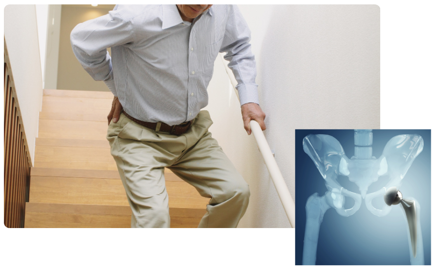 Joint Replacement Surgery in Madgaon, Goa​