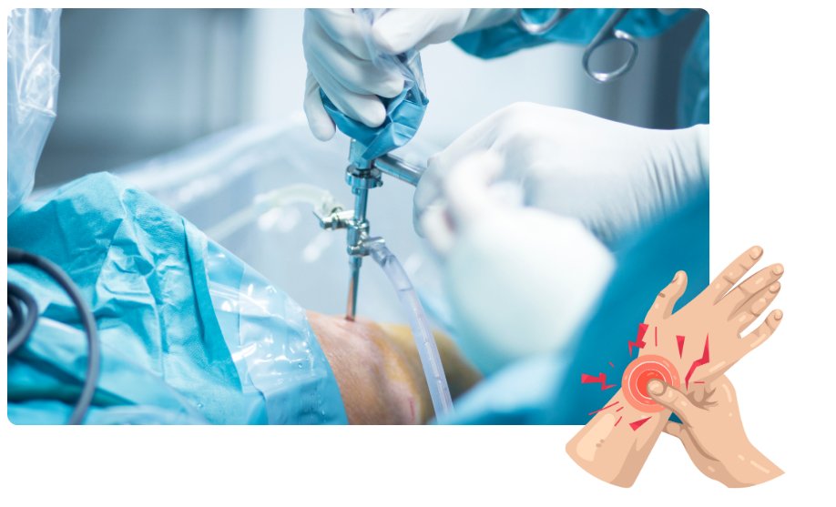Arthroscopy in Madgaon, Goa​