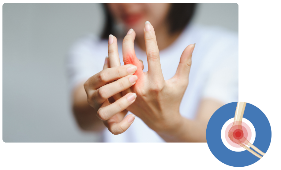 Arthritis Care in Madgaon, Goa​