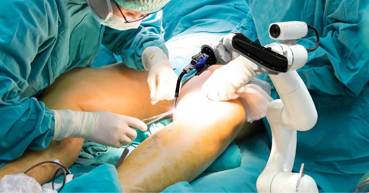 Robotic joint replacement in Goa