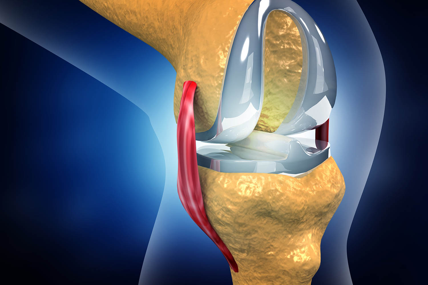 Joint replacement surgery Goa